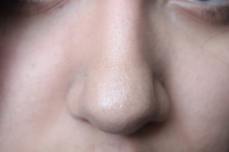 Notice the difference with the foundation on!!! Holy crap! The foundation minimized the appearance of my blackheads/pores. I did not apply concealer around  my nose area at all. 